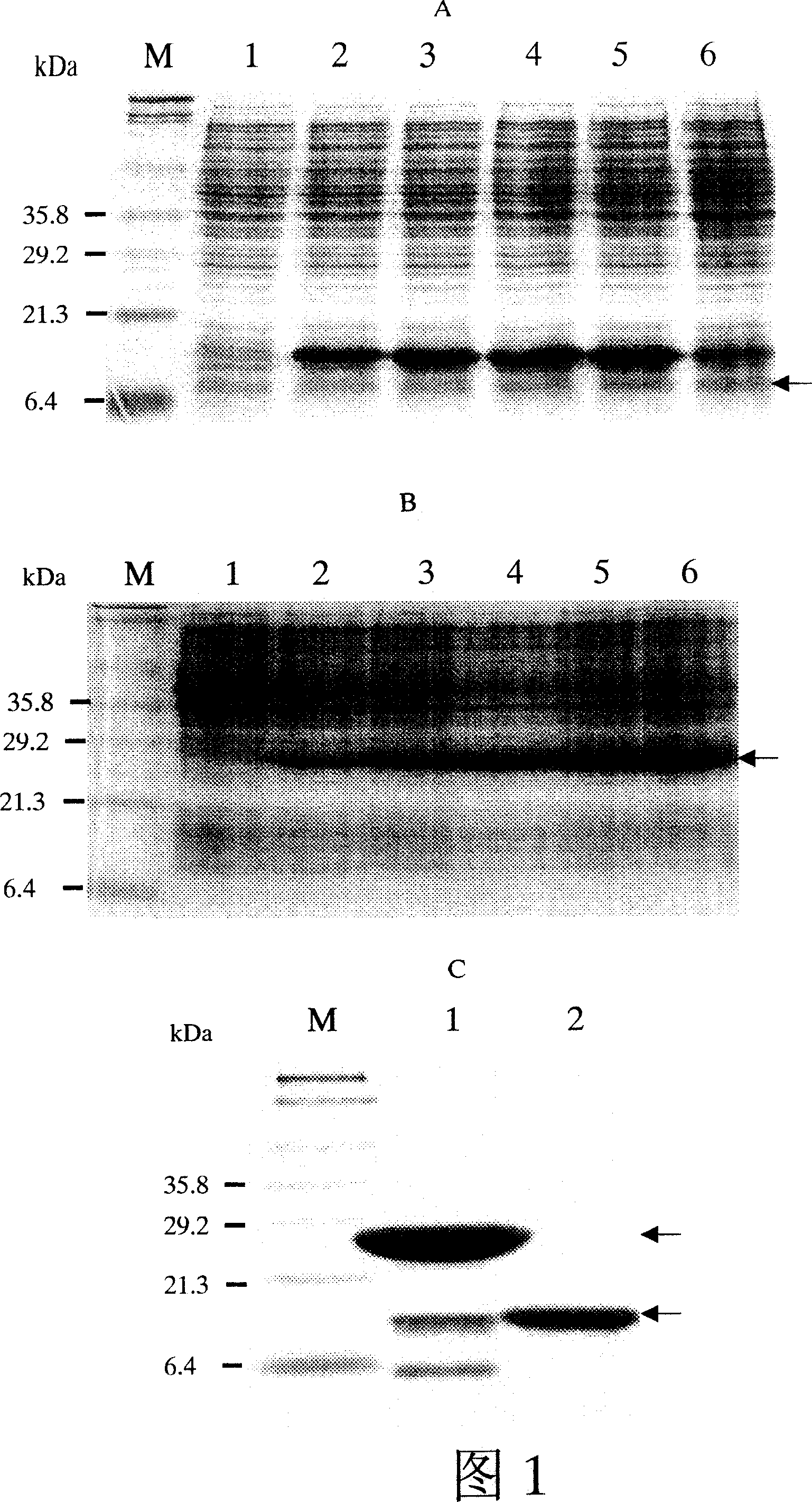 Method for detecting tubercle bacillus antigen in body fluid