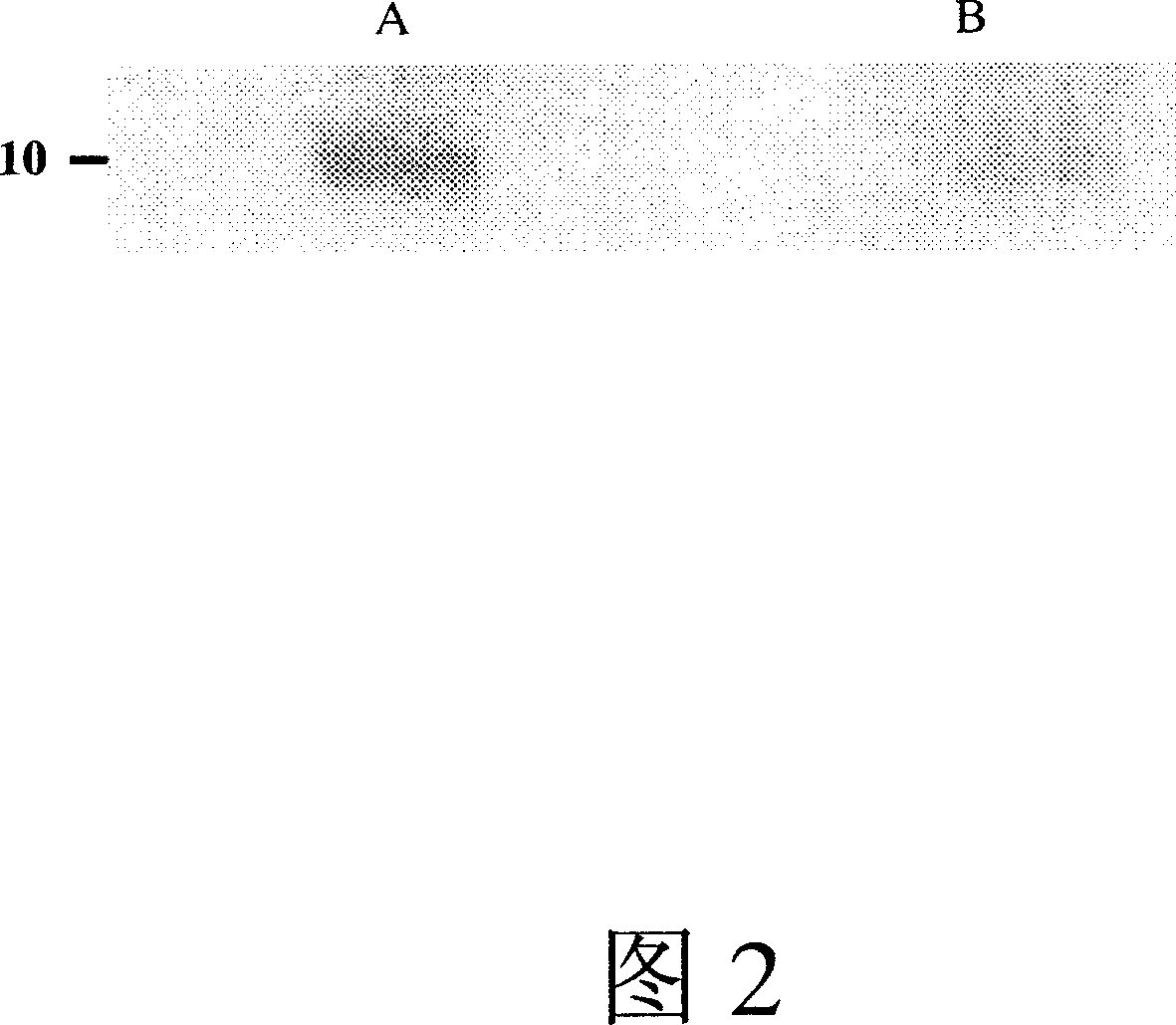 Method for detecting tubercle bacillus antigen in body fluid