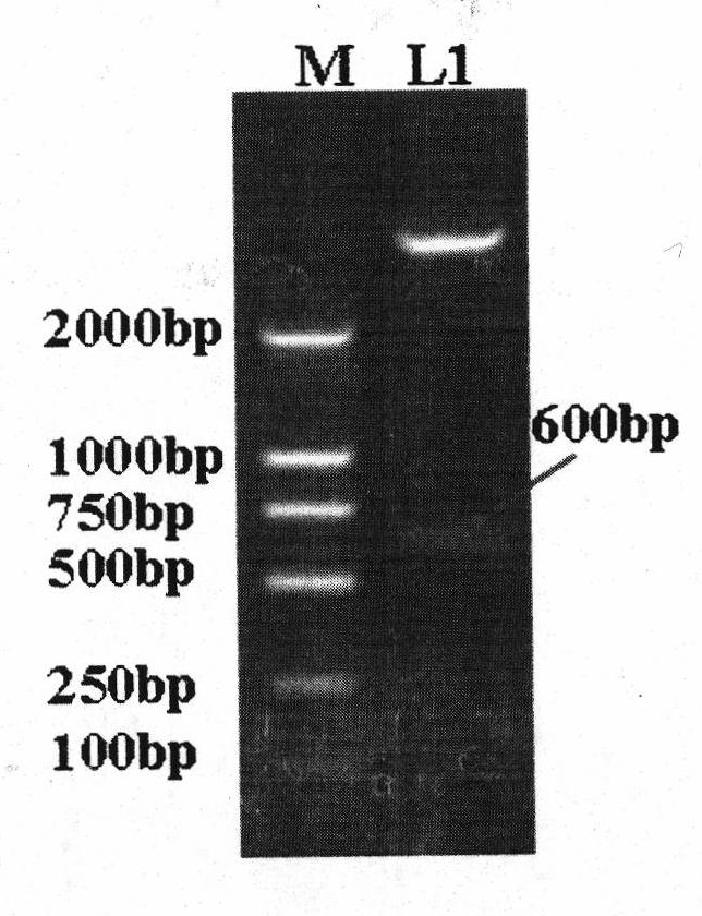 Adenovirus high expression vector for improving expression of hantavirus fusion protein G2S0.7