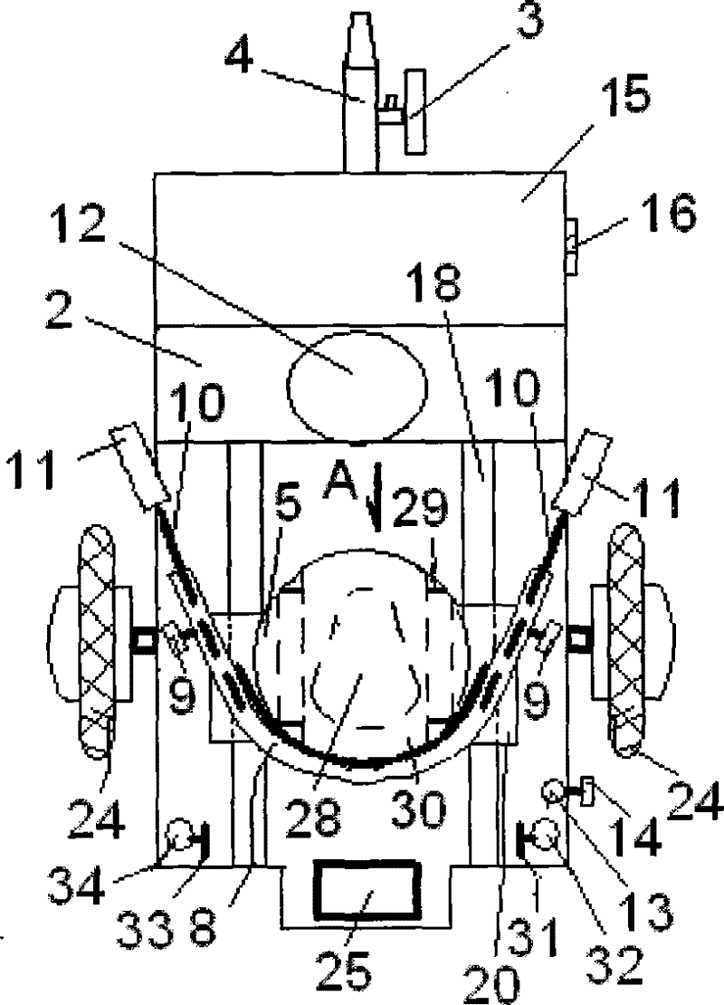 Multifunctional electric barrow provided with baffle and convenient for patients with skeletal trauma