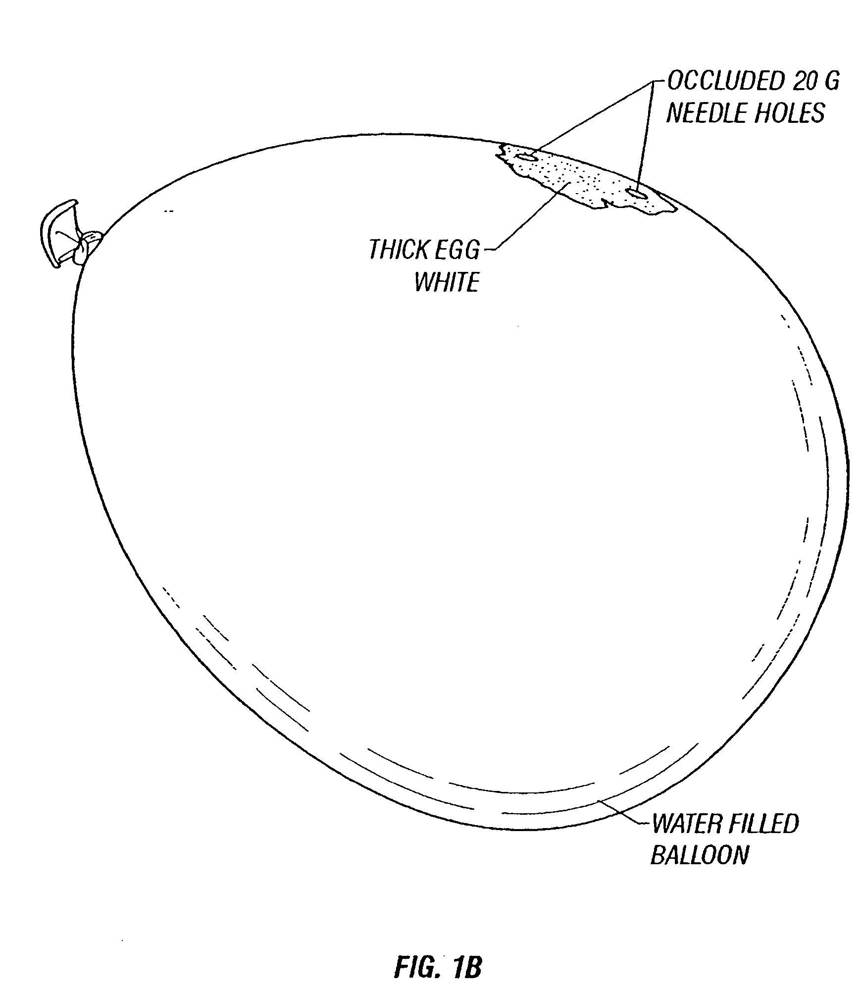 Repair of ruptured membrane by injection of naturally occurring protein in amniotic fluid