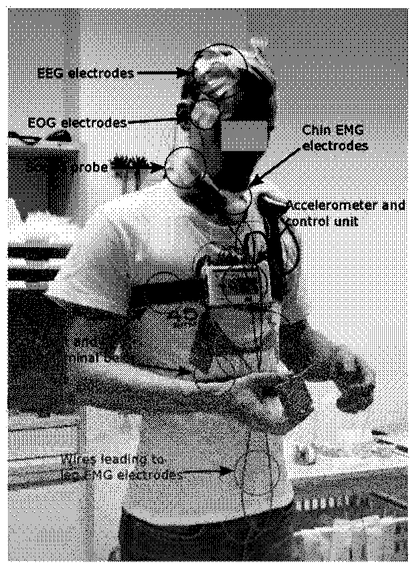 Wearable sleep monitor and monitoring method