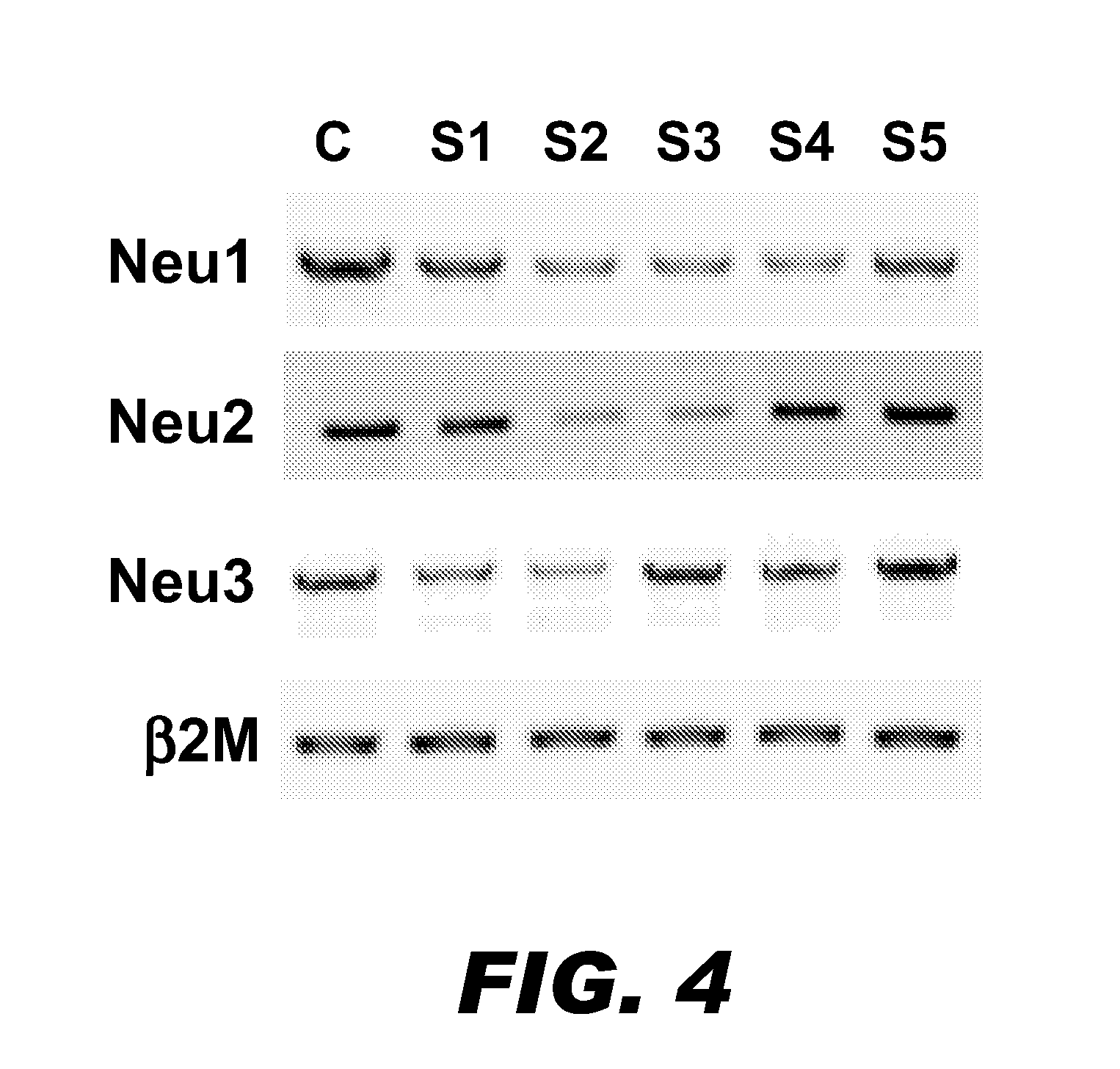 Compositions and methods for improved glycoprotein sialylation