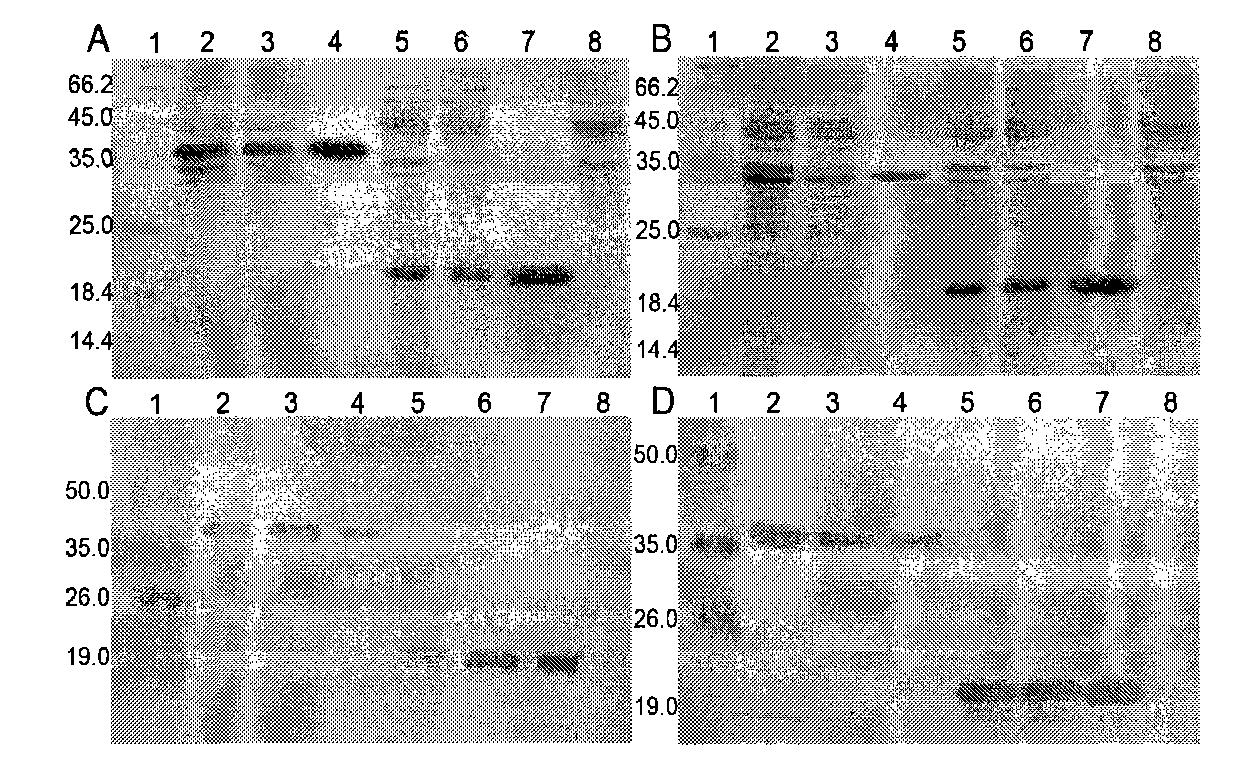 Recombined protein specially combined with fiber protein and application thereof