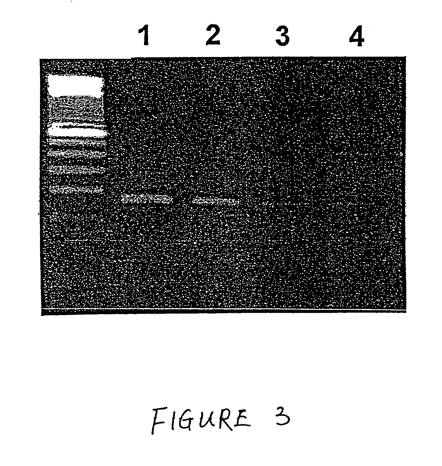 Method for the detection of Chagas disease related gene transcripts in blood