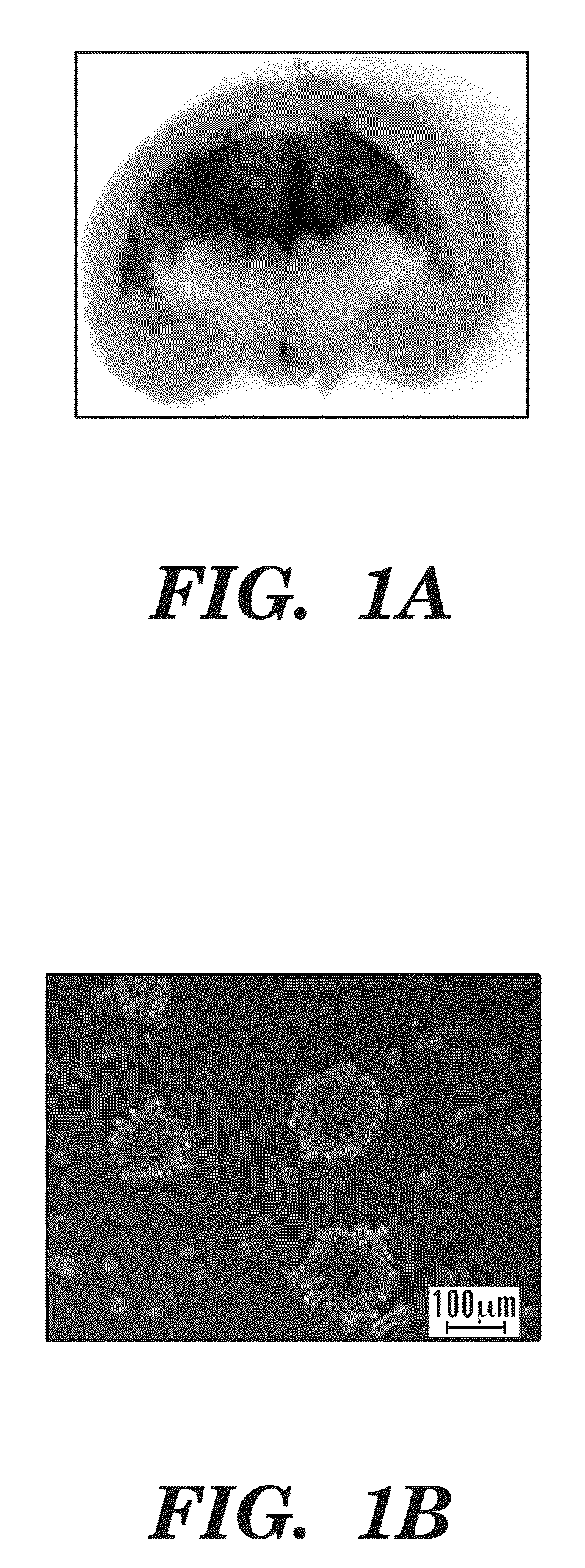 Diagnostic and prognosis methods for cancer stem cells