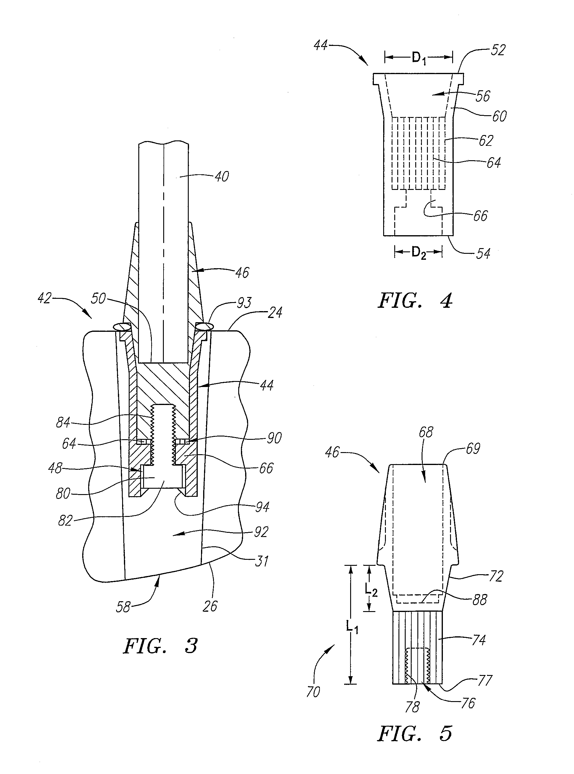 Iron-type golf club with interchangeable head-shaft connection