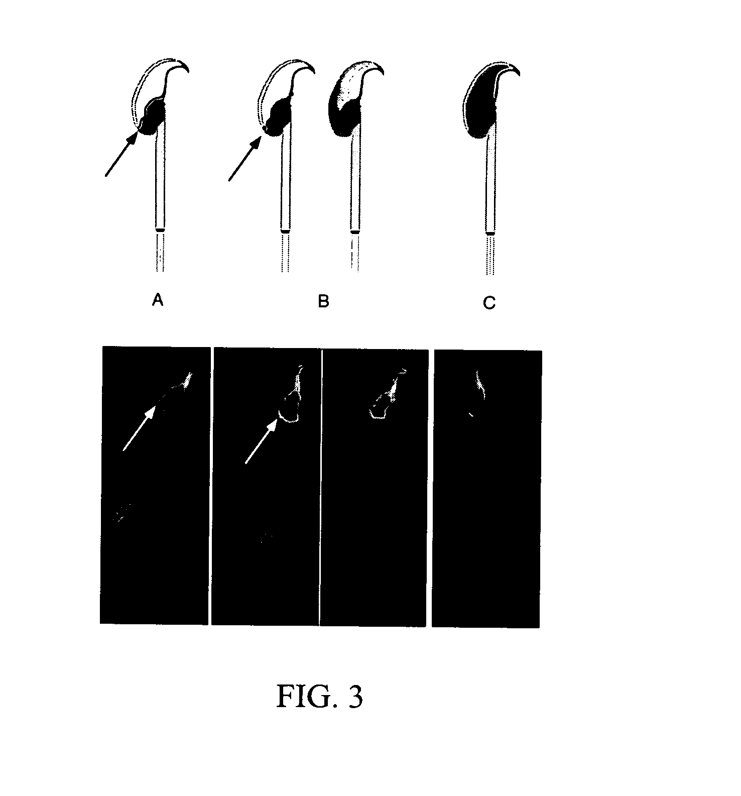 Method of determining sperm capacitation