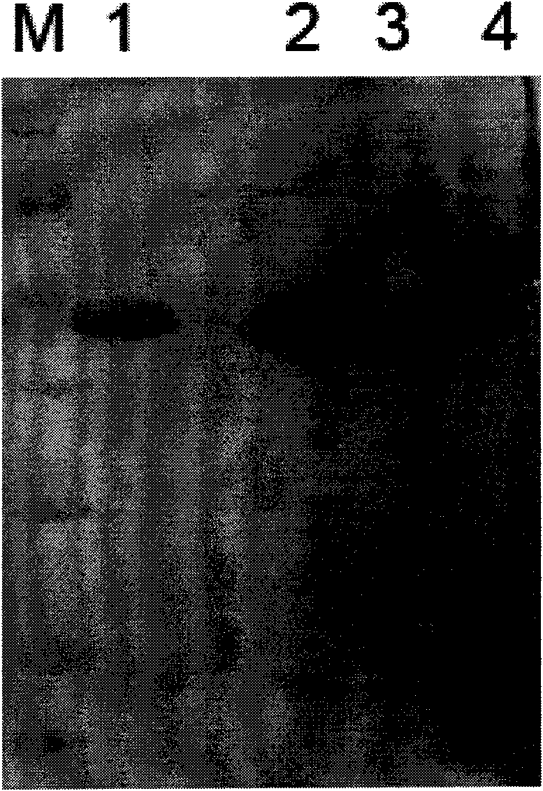 Efficient endoglucanase RuCelB, coded gene, preparation method and application thereof