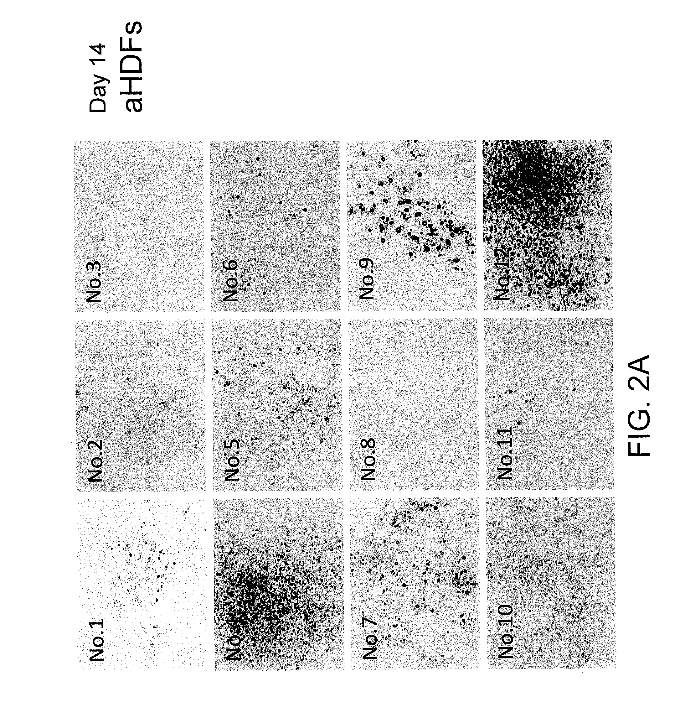 Brown fat cells and method for preparing same