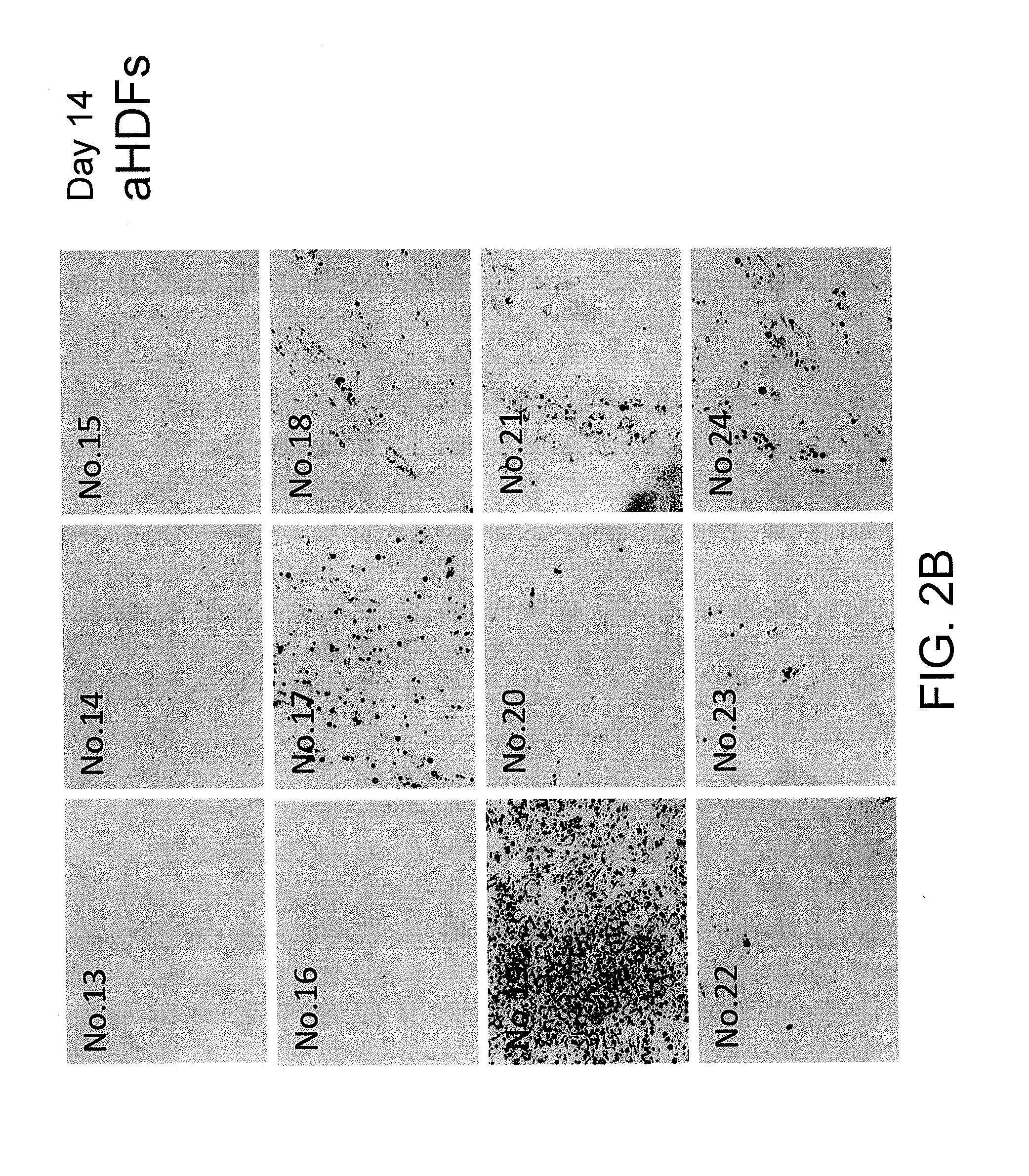 Brown fat cells and method for preparing same