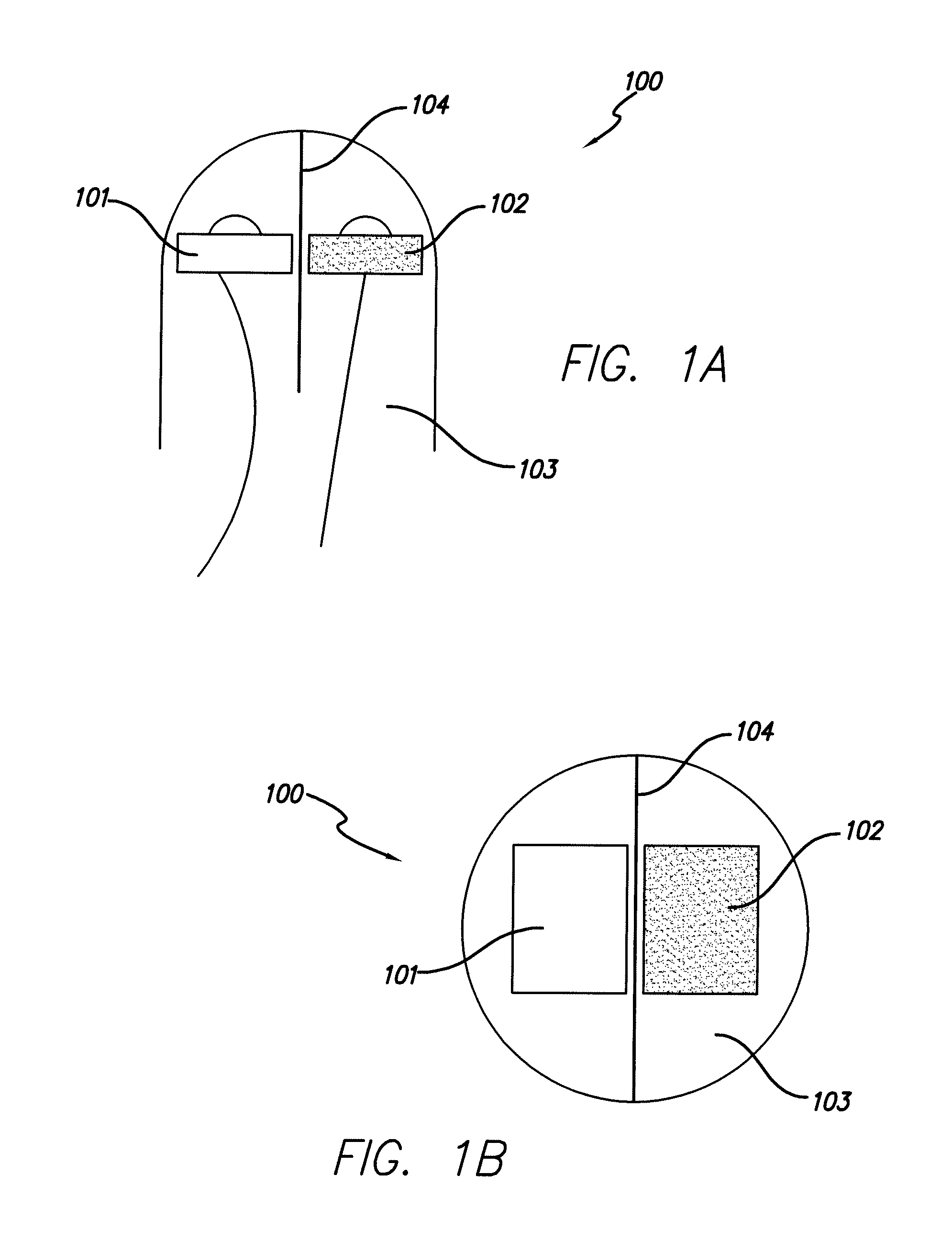 Apparatus and method for treating obstructive sleep apnea