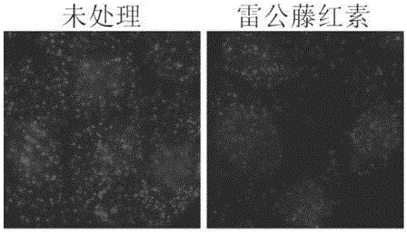 Screening method of anticancer medicine