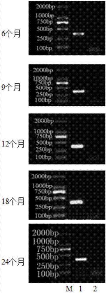 Storage method of transgenic streptococcus suis serotype MRP engineered microorganisms