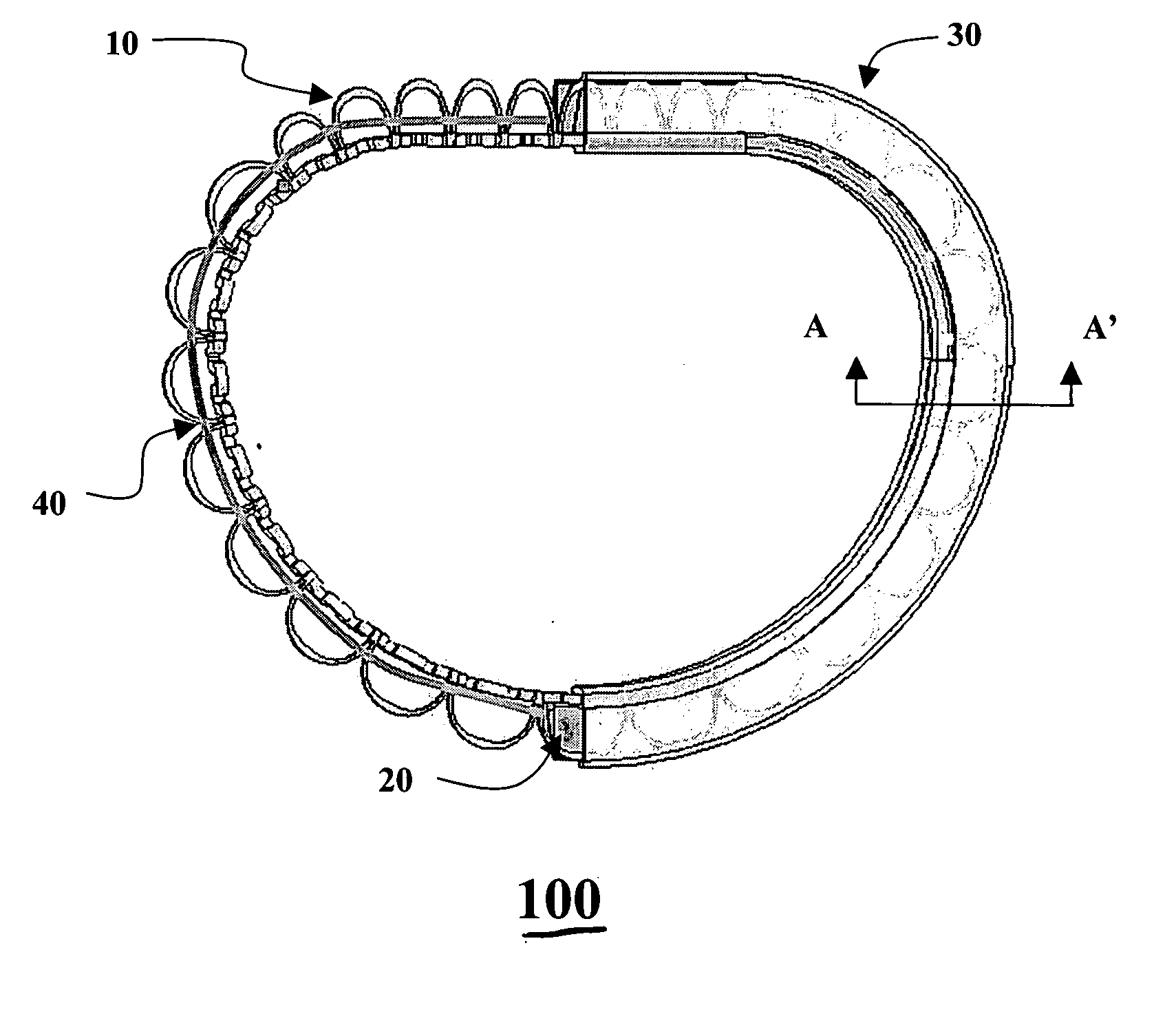 Valvular support prosthesis