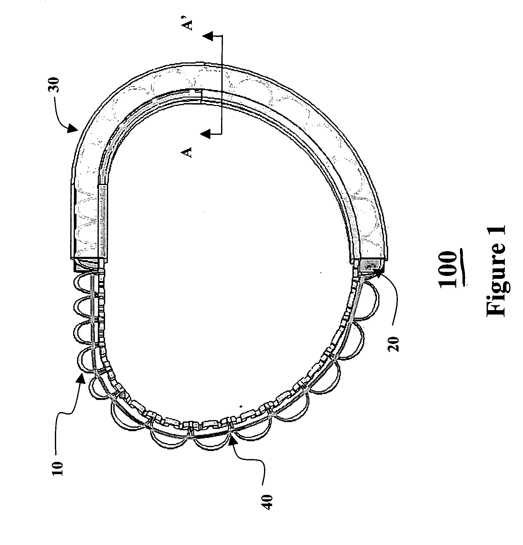 Valvular support prosthesis