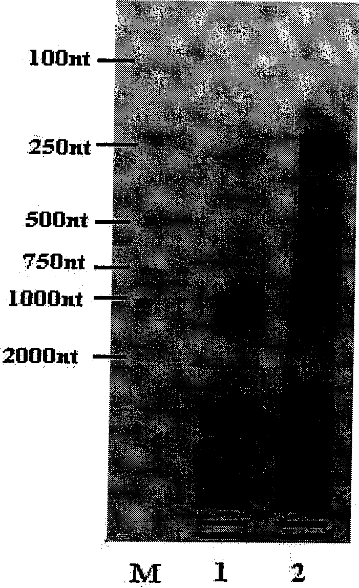 Antimicrobial peptide gene of portunus trituberculatus and clone method