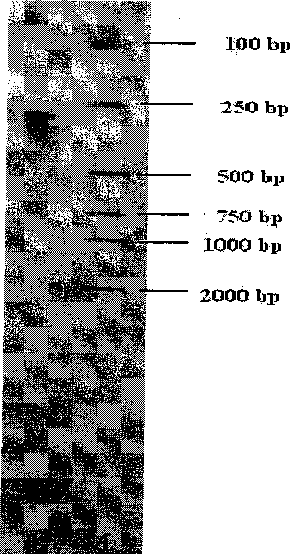 Antimicrobial peptide gene of portunus trituberculatus and clone method