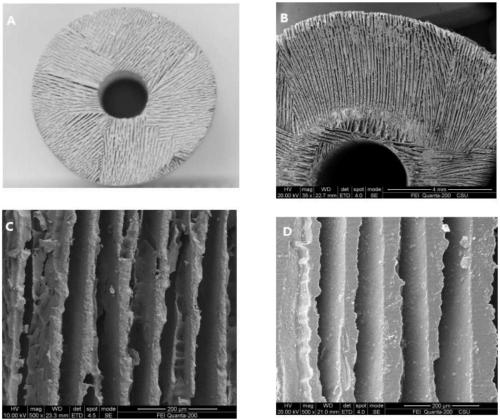 Individual calcium phosphate bionic bone tissue bracket and preparation method and application thereof