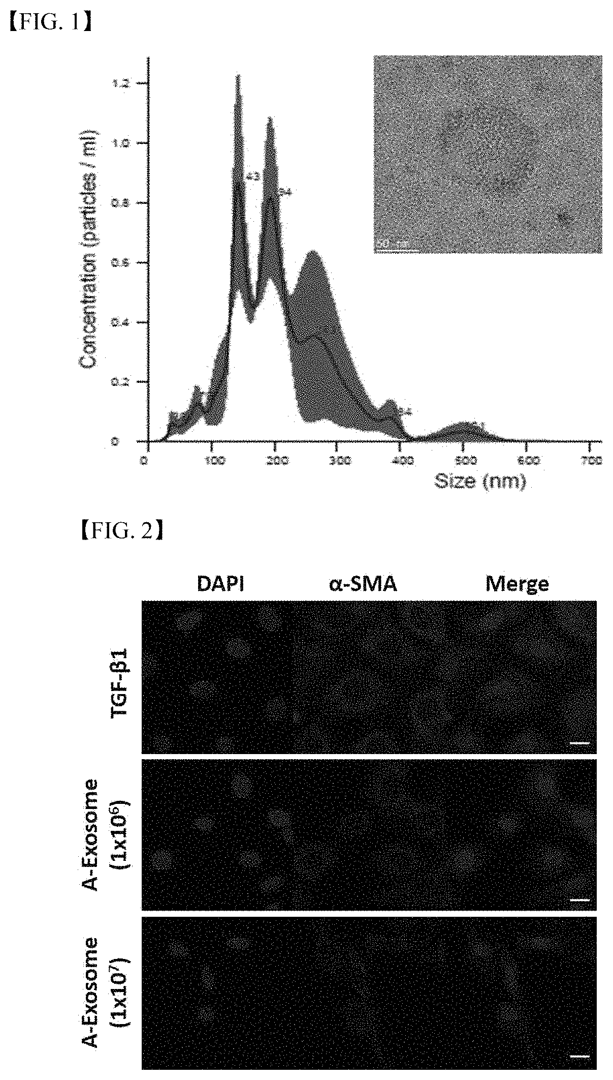 Treating liver fibrosis using adipose stem cell-derived exosomes as active ingredient