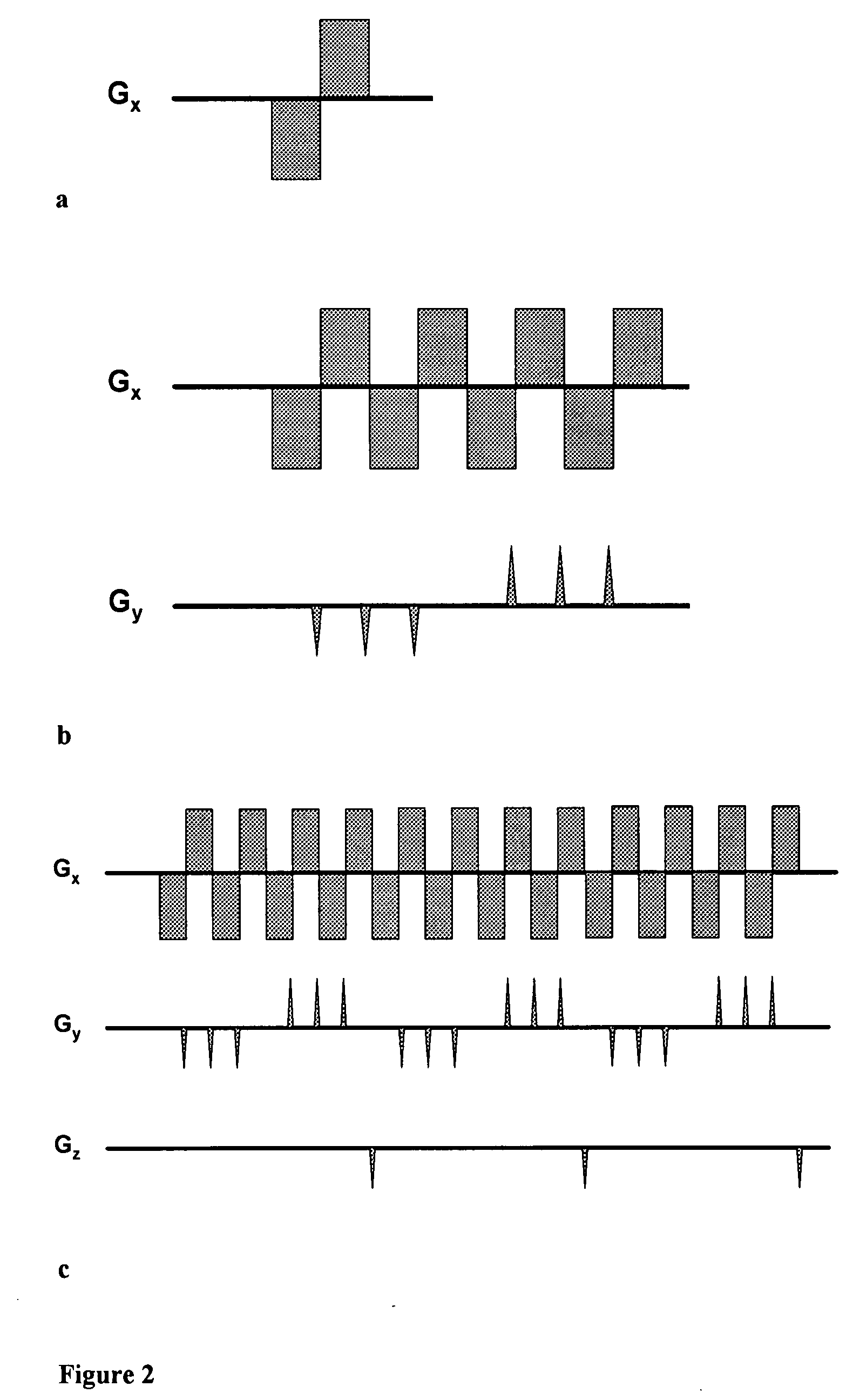 Magnetic resonance spectroscopy with sparse spectral sampling and interleaved dynamic shimming