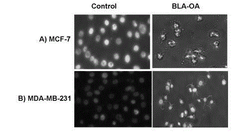 Cow milk protein fatty acid modifier capable of inducing human breast cancer cell apoptosis, and preparation method thereof