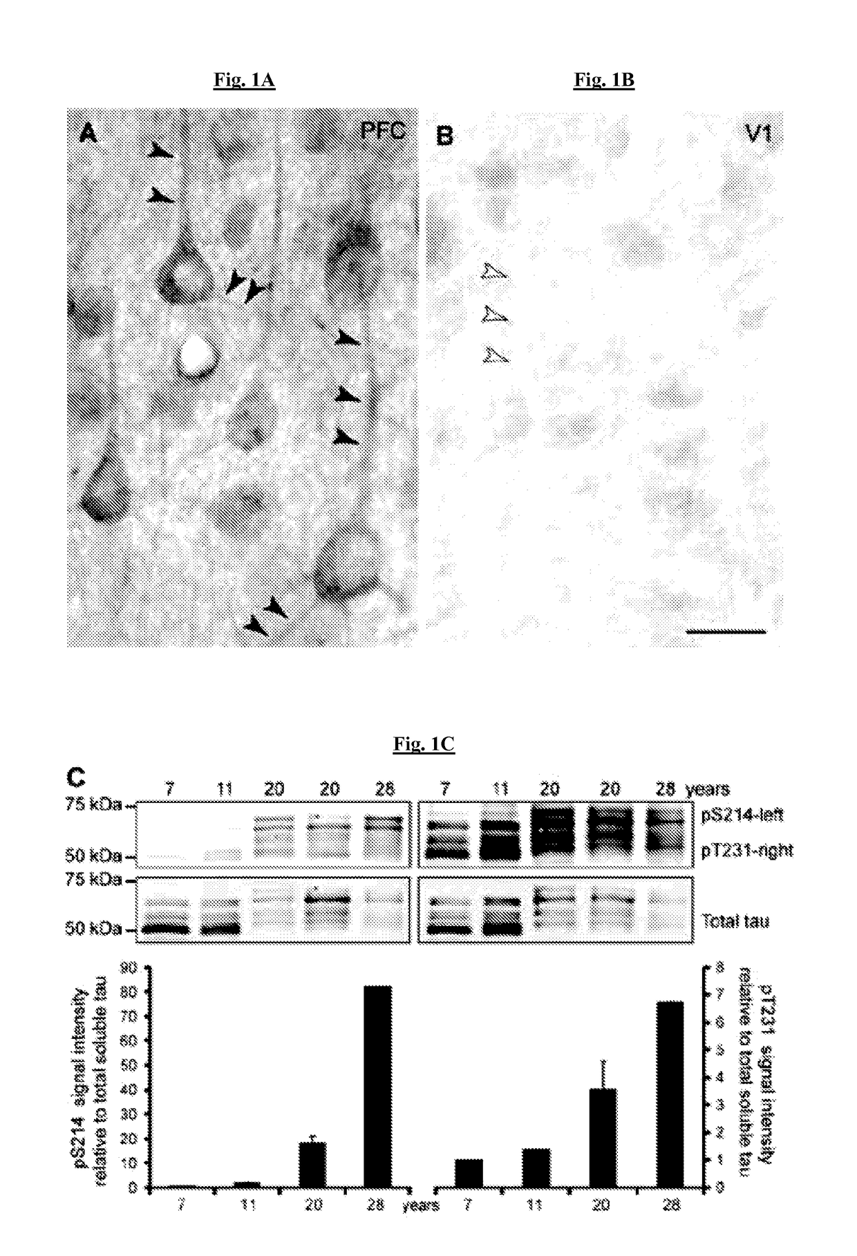 Methods of preventing neurodegeneration of association cortex in a mammal