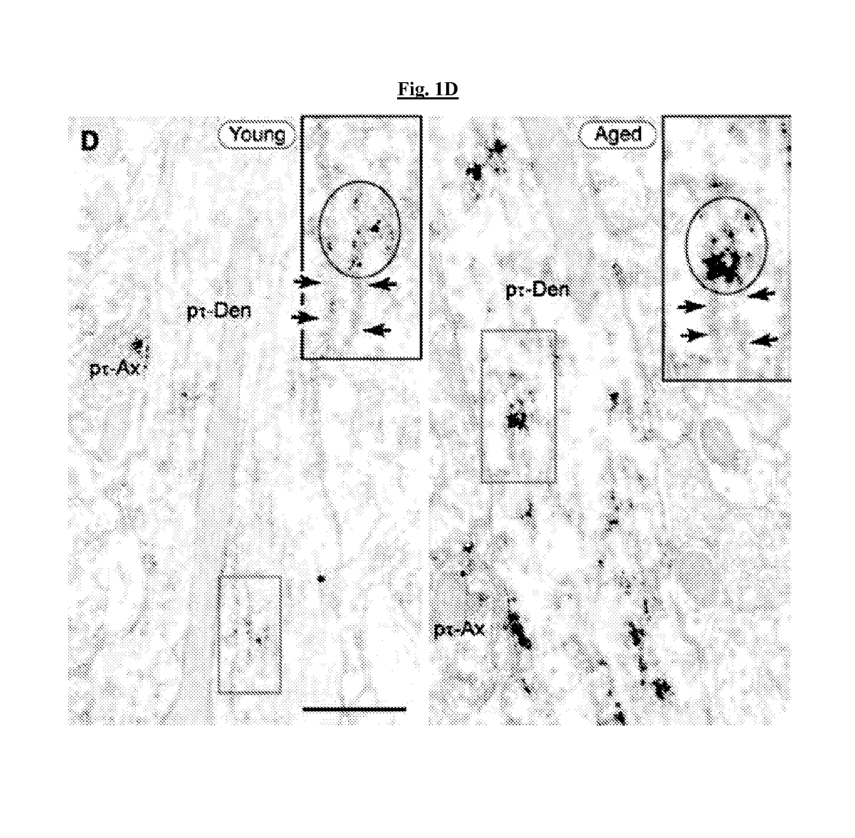 Methods of preventing neurodegeneration of association cortex in a mammal