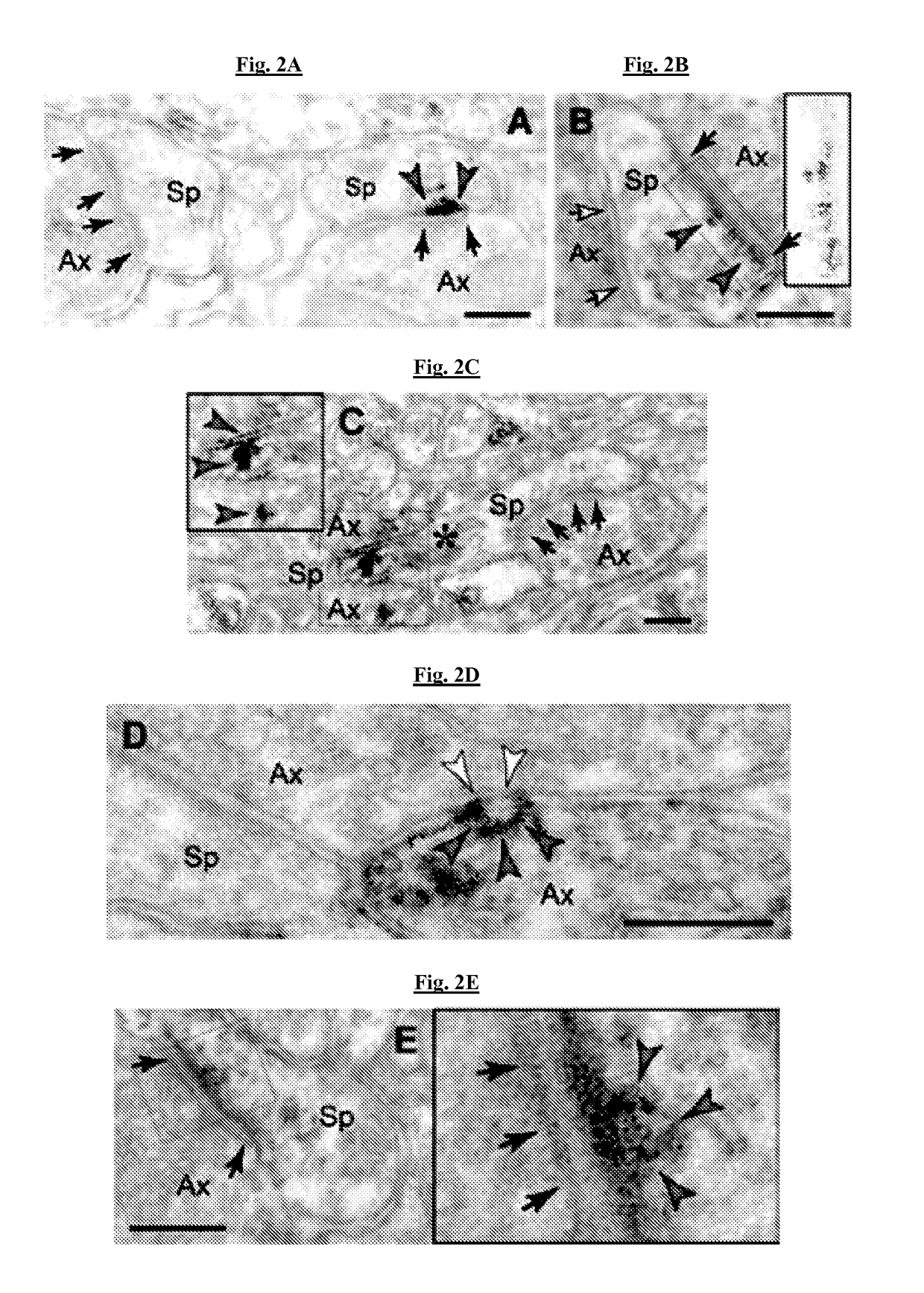 Methods of preventing neurodegeneration of association cortex in a mammal