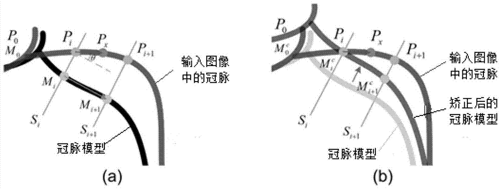 A method for extracting coronary arteries