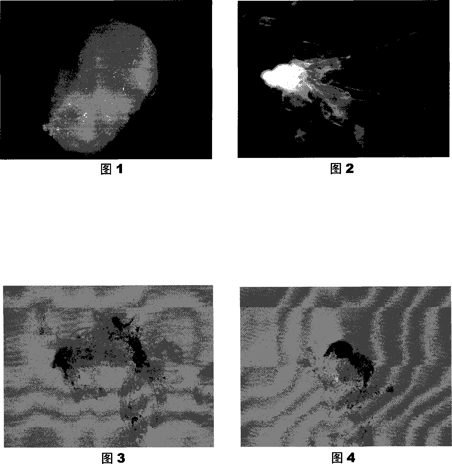 Fujian cypress somatic cell embryogenesis and plant regeneration technique