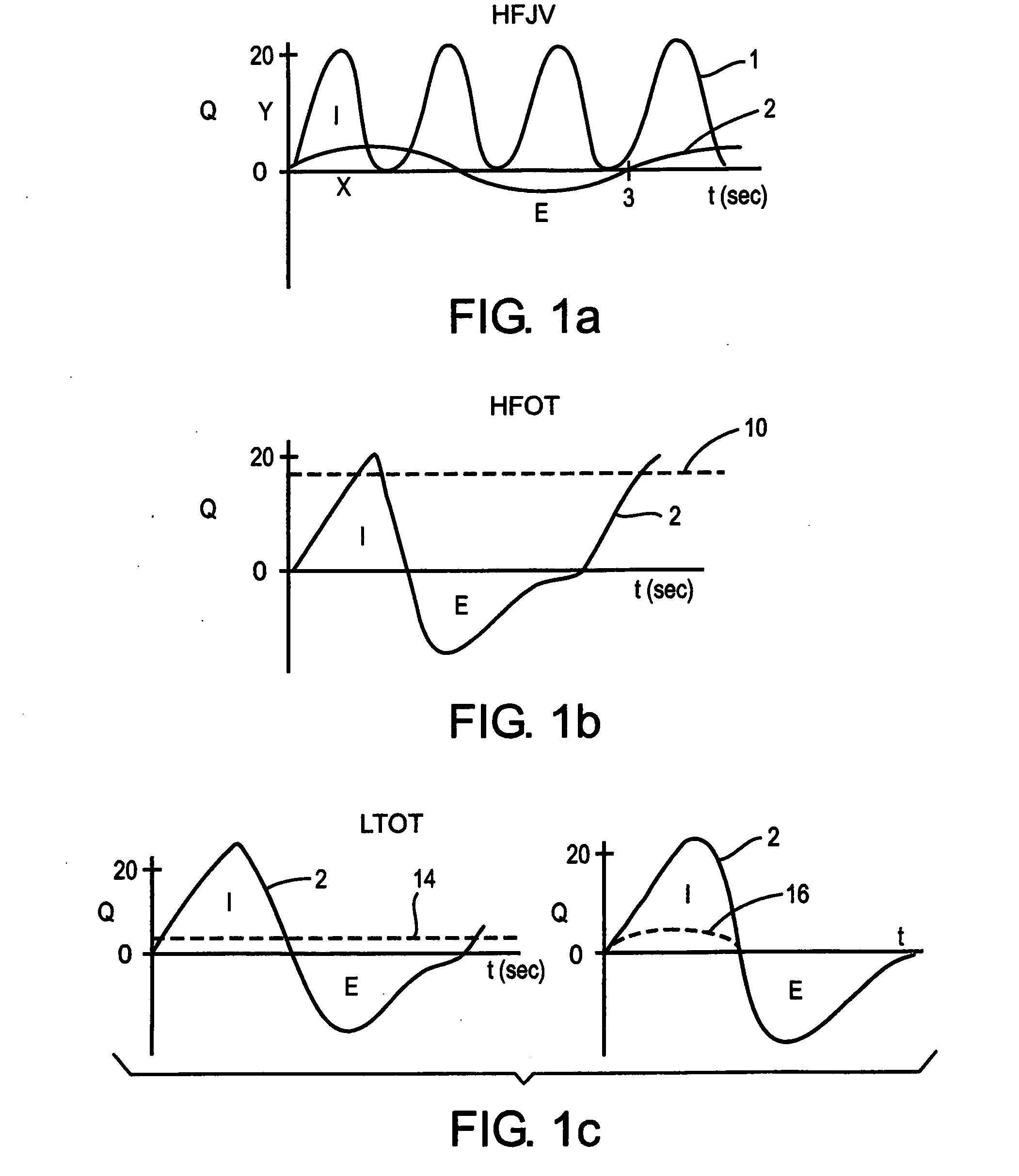 Methods and devices for minimally invasive respiratory support