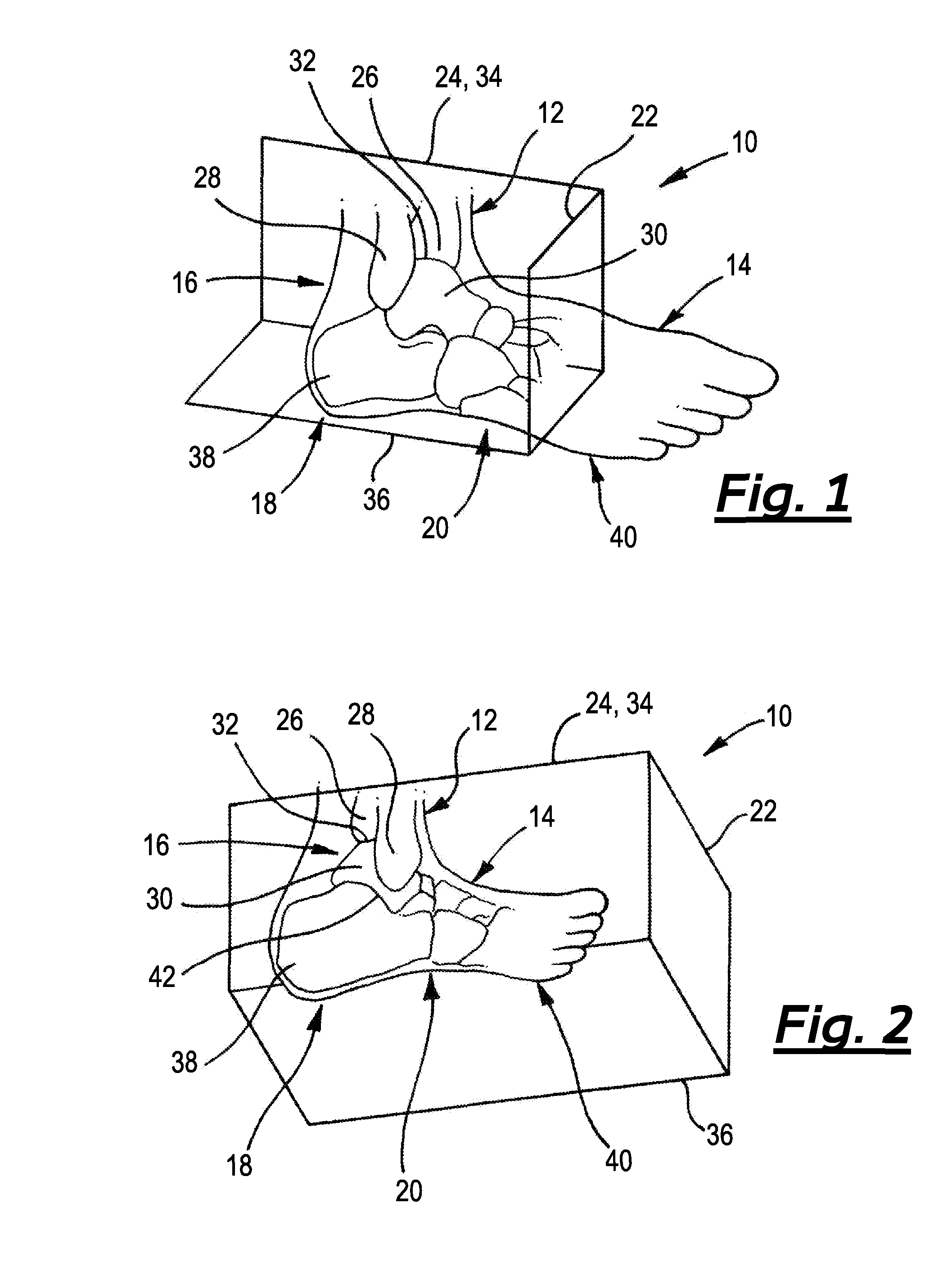 Ankle foot orthopaedic devices