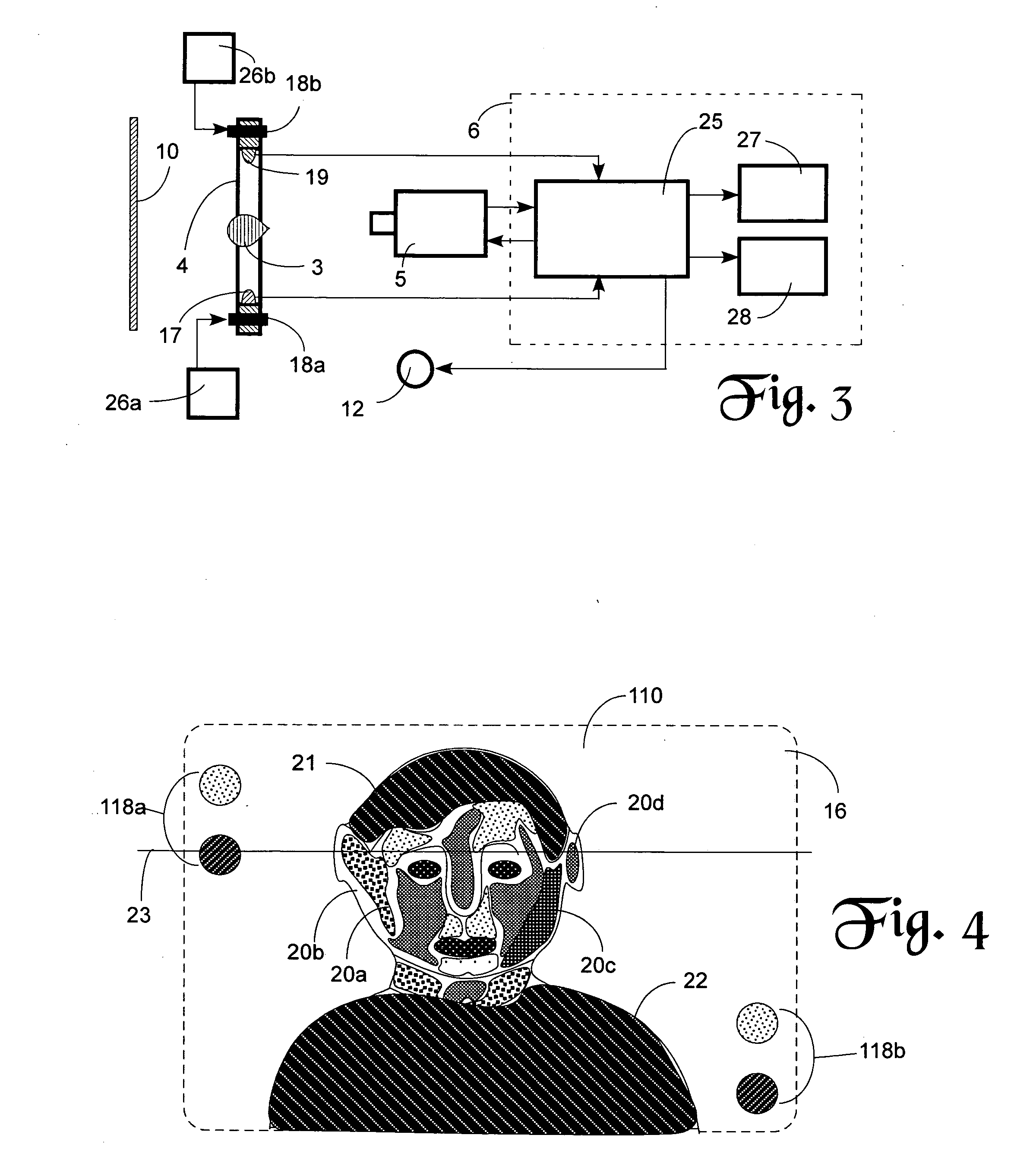 Noncontact fever screening system