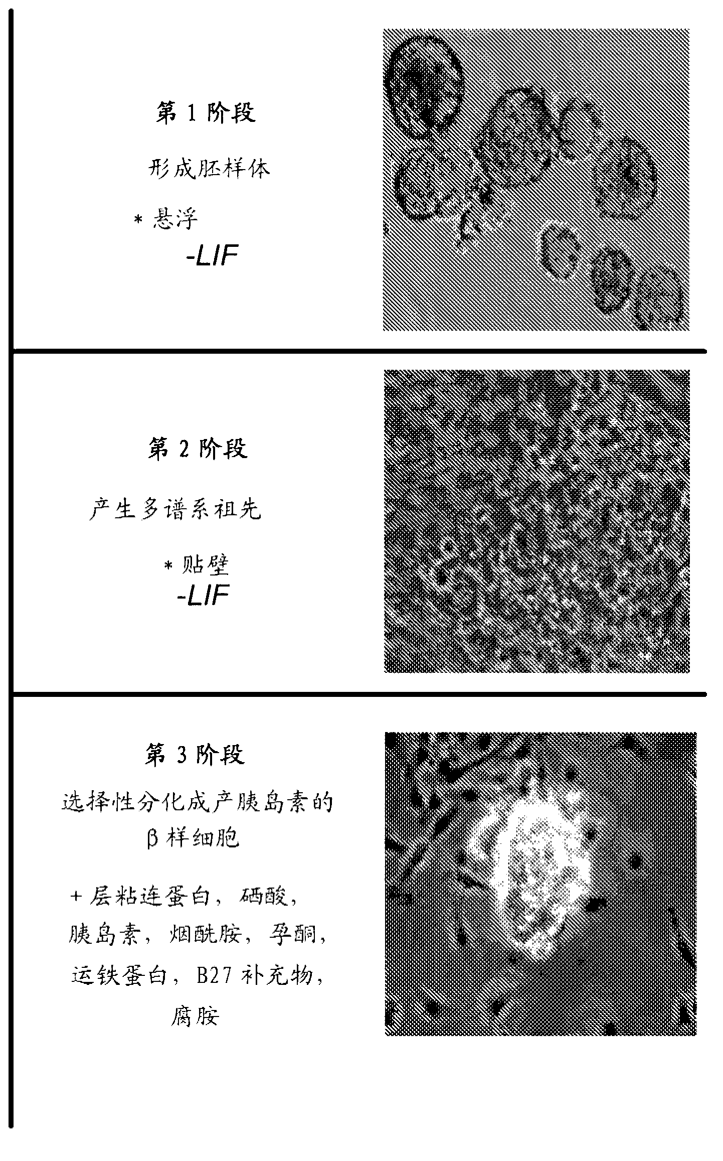 Methods and compositions for treating diabetes with iPS derived pancreatic beta-like cells