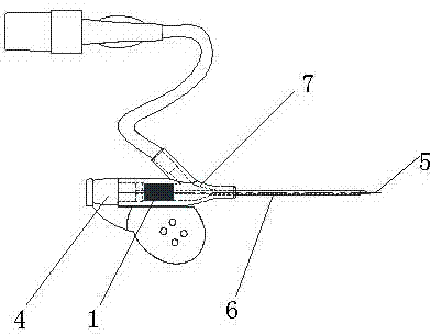 Arteriovenous indwelling needle sealing plug