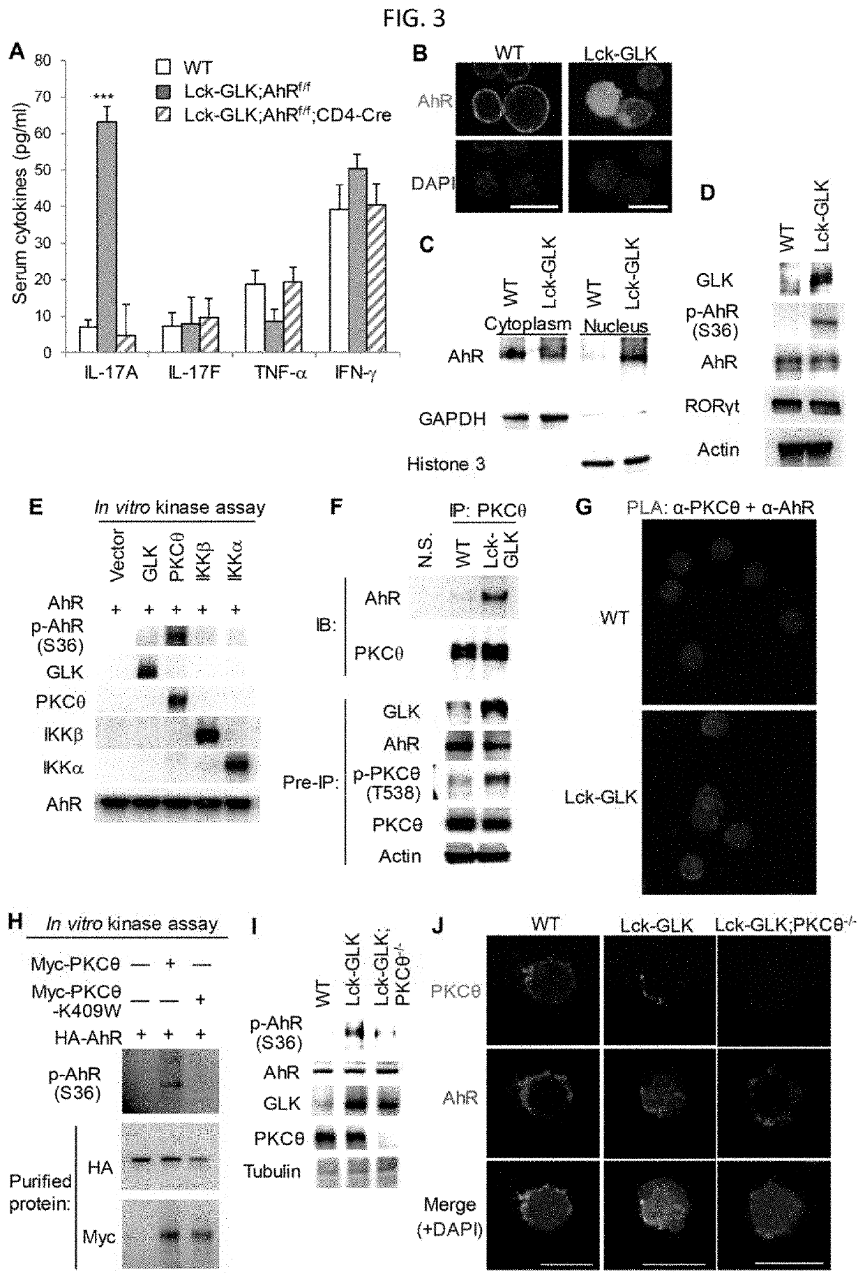 AhR-ROR-γt complex as a biomarker and therapeutic target for autoimmune disease and IL-17A-associated disease