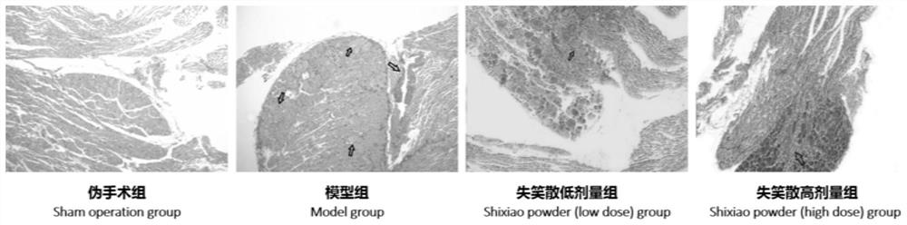 Application of Shixiaosan in preparation of medicine for treating endometriosis pain symptom