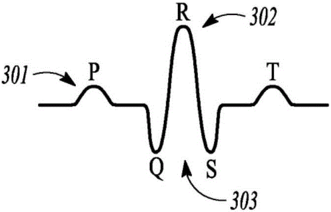 Atrial fibrillation detection using ventricular rate variability