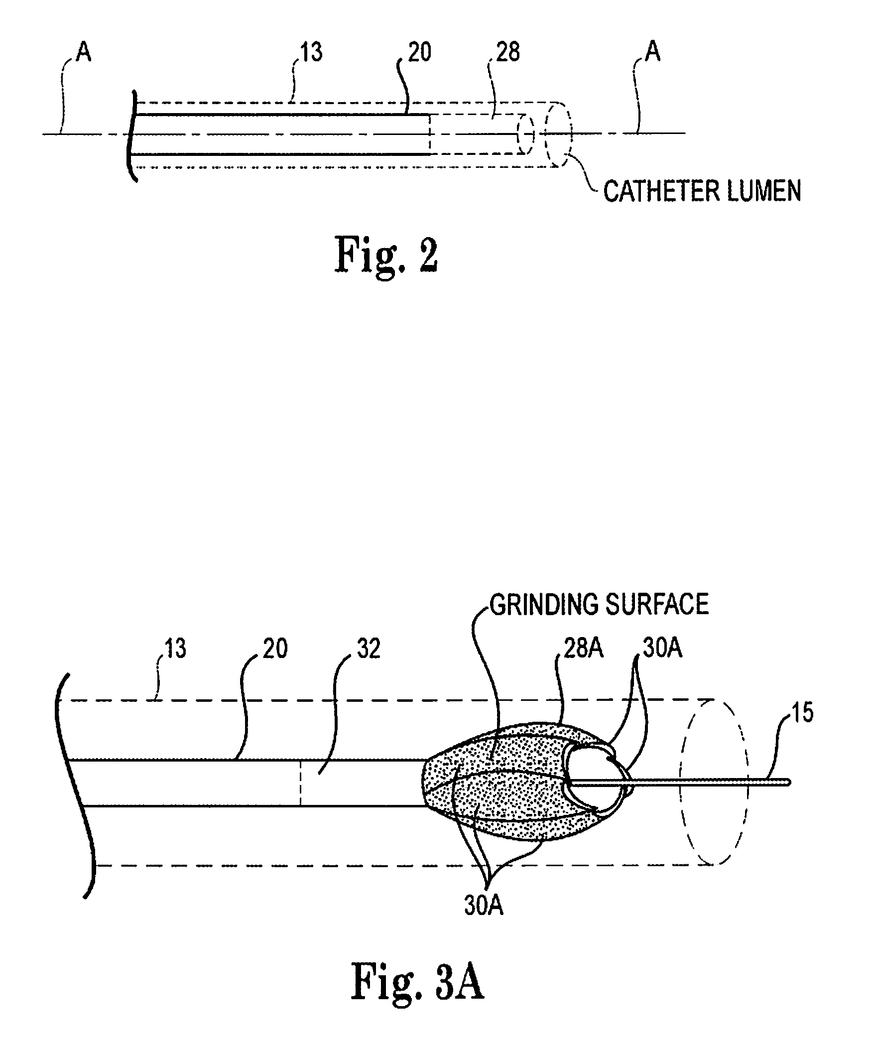 Atherectomy device, system and method having a bi-directional distal expandable ablation element