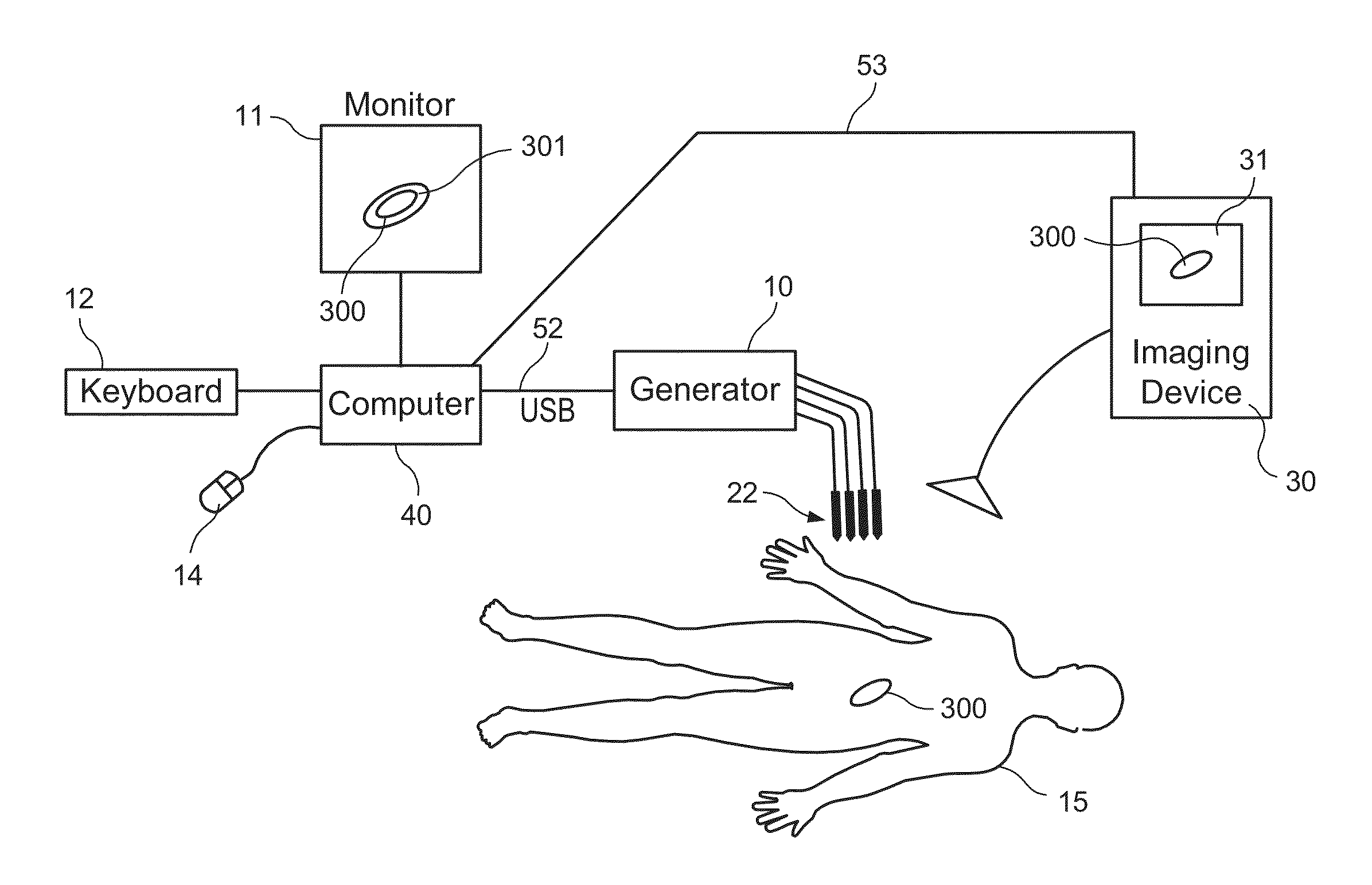 System and method for increasing a target zone for electrical ablation