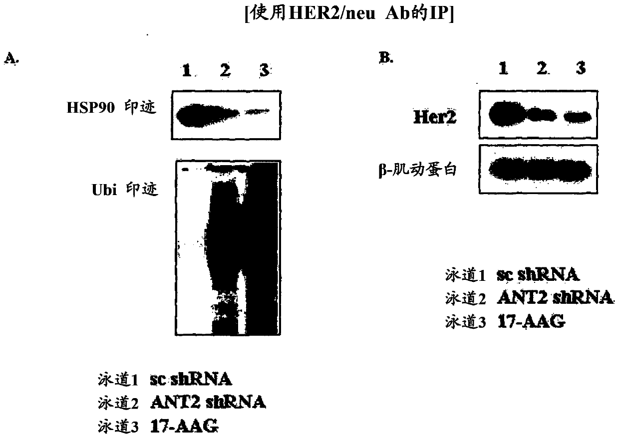 Method for treating breast cancer by decreasing the expression of adenine nucleotide translocator 2 mRNA