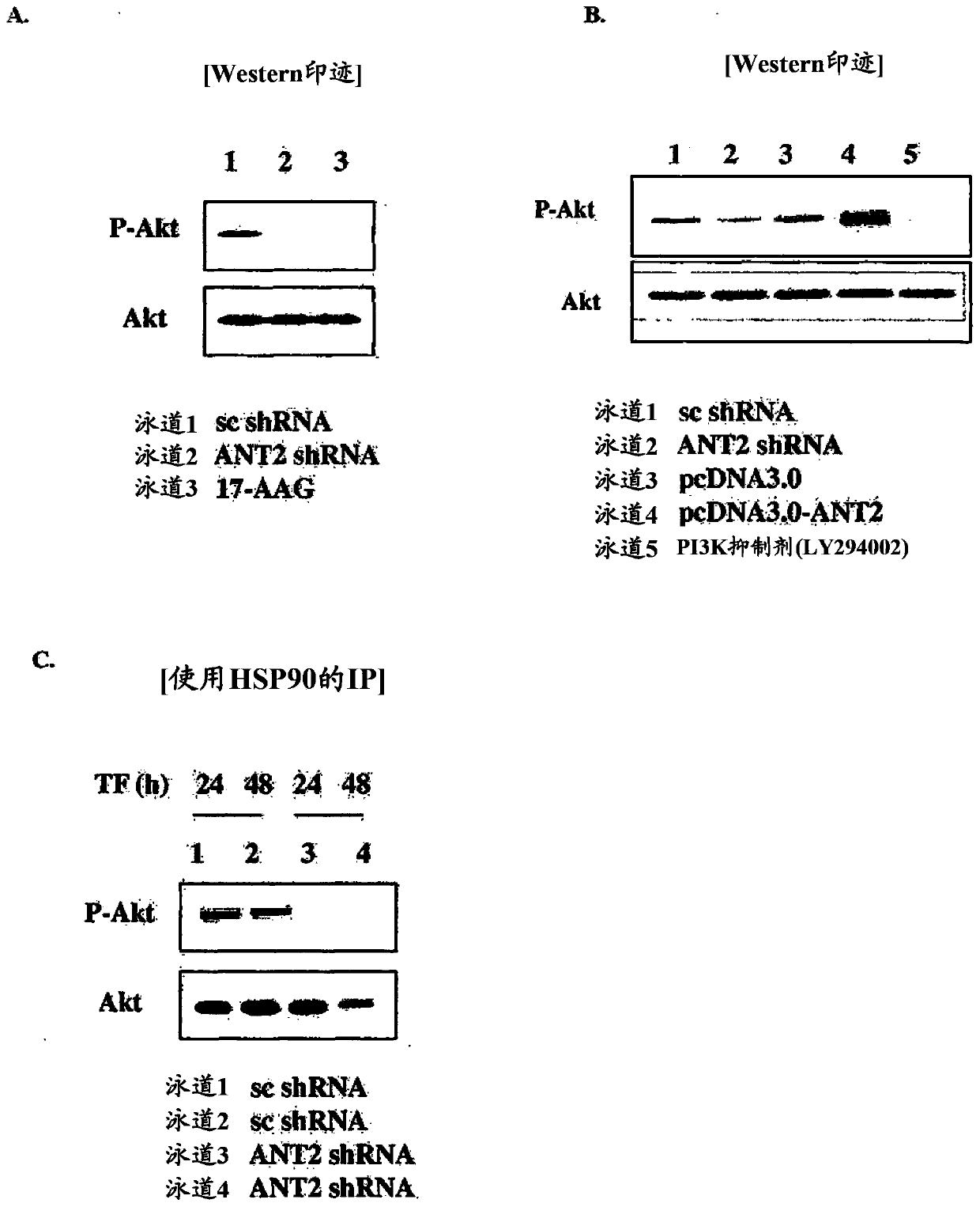 Method for treating breast cancer by decreasing the expression of adenine nucleotide translocator 2 mRNA