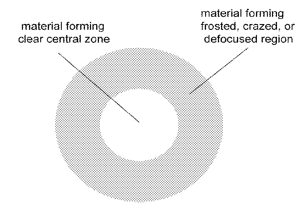 High performance corneal inlay