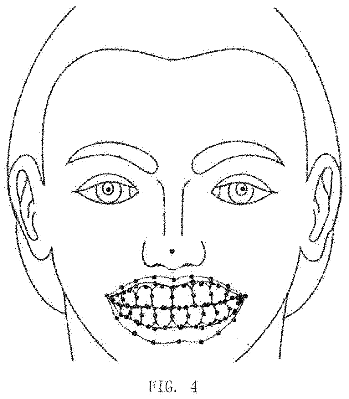 C/S Architecture-Based Dental Beautification AR Smart Assistance Method and Apparatus