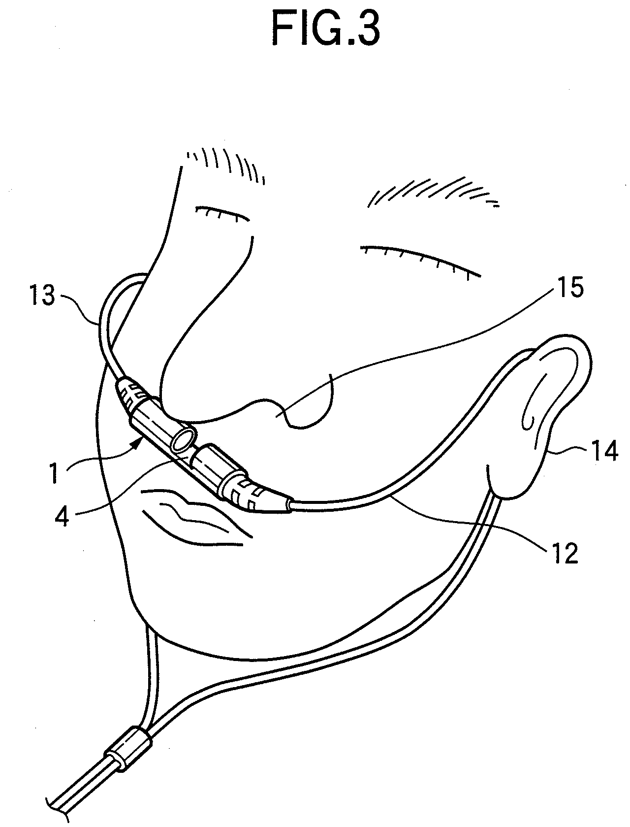 Sensor for measuring carbon dioxide in respiratory gas