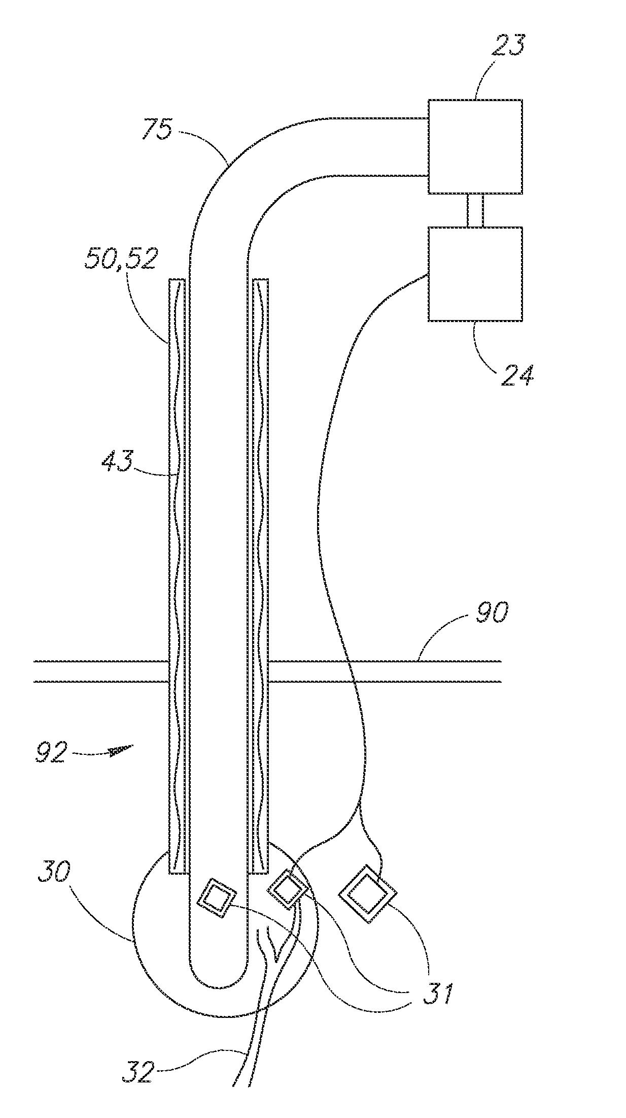 Non-invasive and minimally invasive and tightly targeted minimally invasive therapy methods and devices for parathyroid treatment