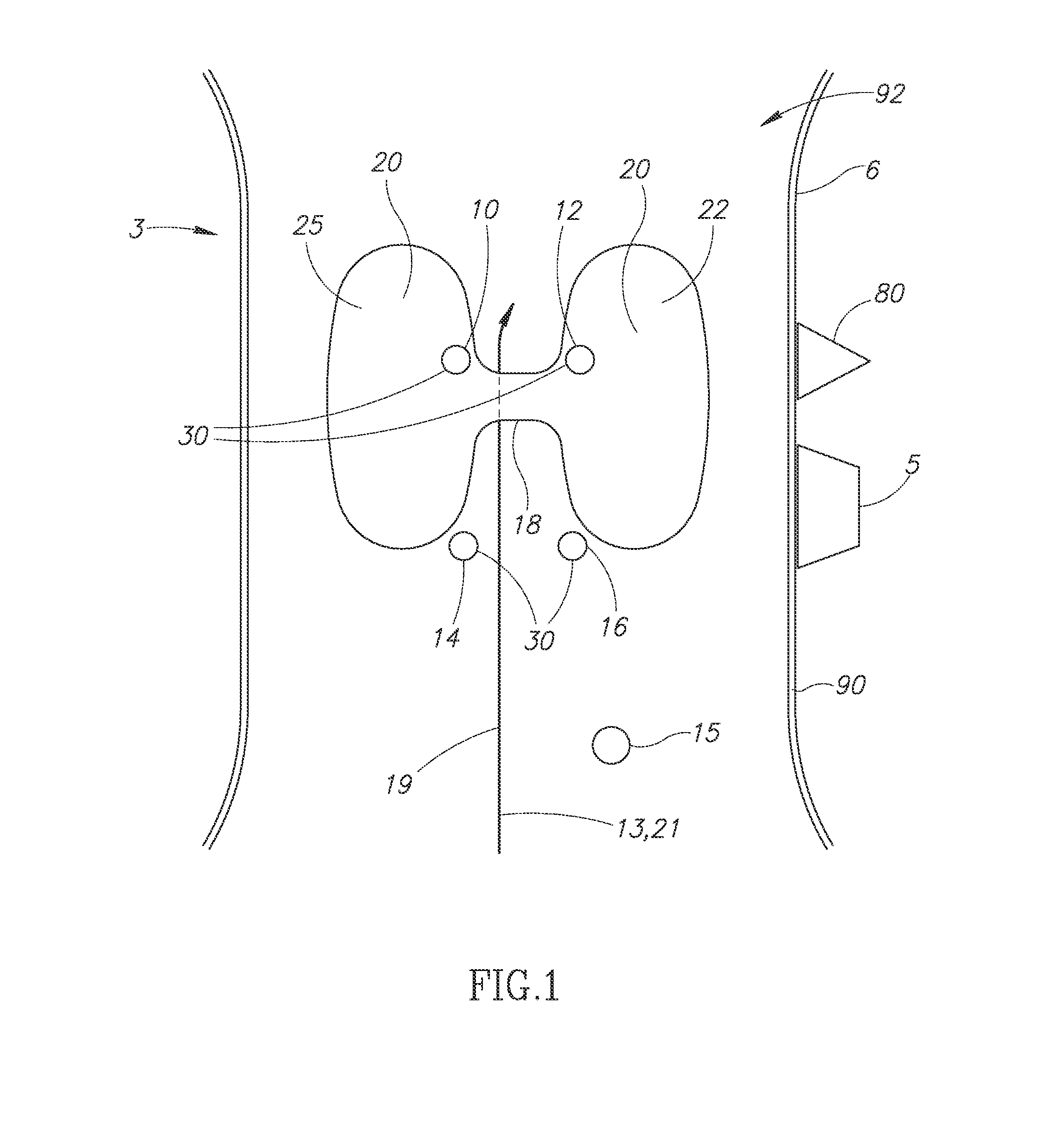 Non-invasive and minimally invasive and tightly targeted minimally invasive therapy methods and devices for parathyroid treatment