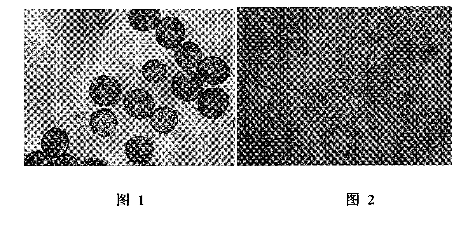 Preparation method of alginate/epsilon-polylysine/alginate biological microcapsule