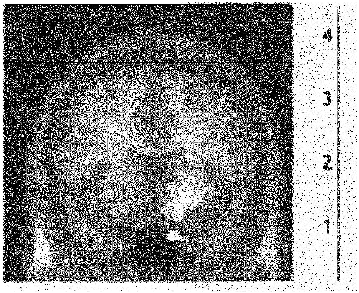 Botulinum toxin for primary disorders of mood and affect using neurotransmitter